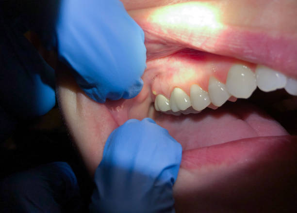 Best Cracked Tooth Emergency Dentist  in East Freehold, NJ